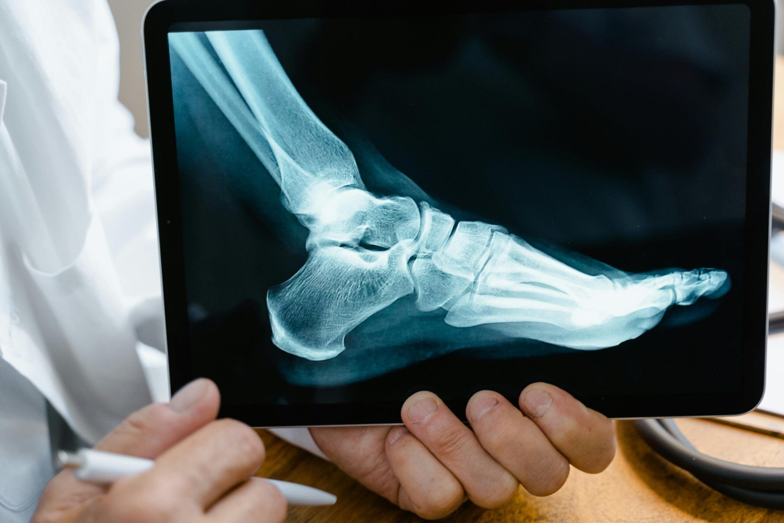 Knee pain illustration Knee pain illustration